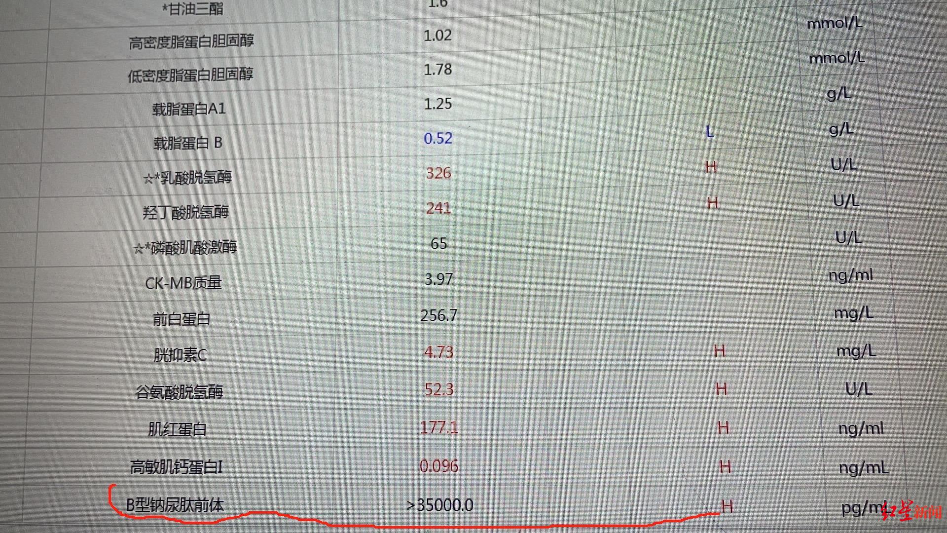 90后年轻妈妈发现妊娠高血压置之不理8年后确诊尿毒症紧急转入icu