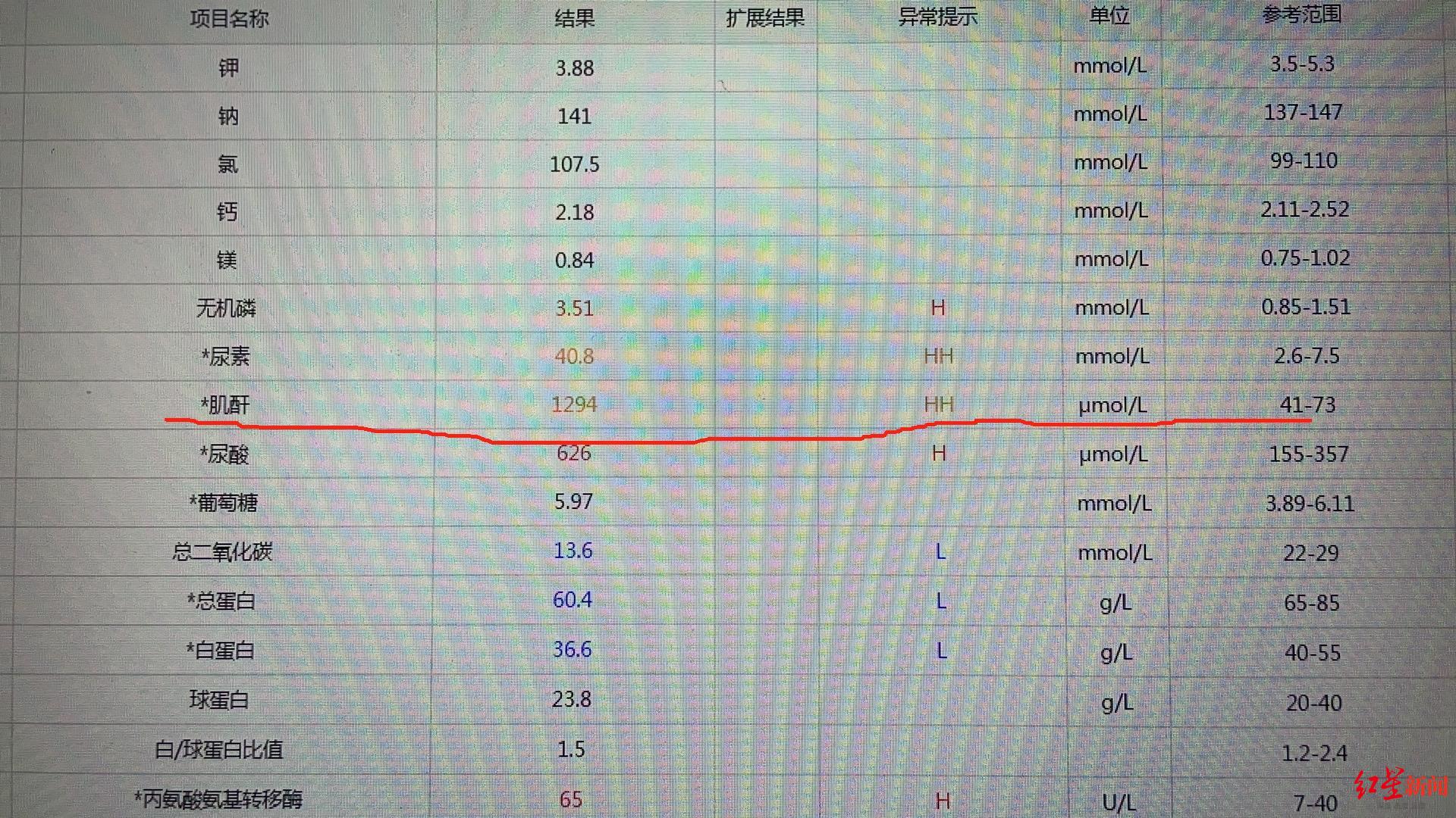 90后年轻妈妈发现妊娠高血压置之不理8年后确诊尿毒症紧急转入icu