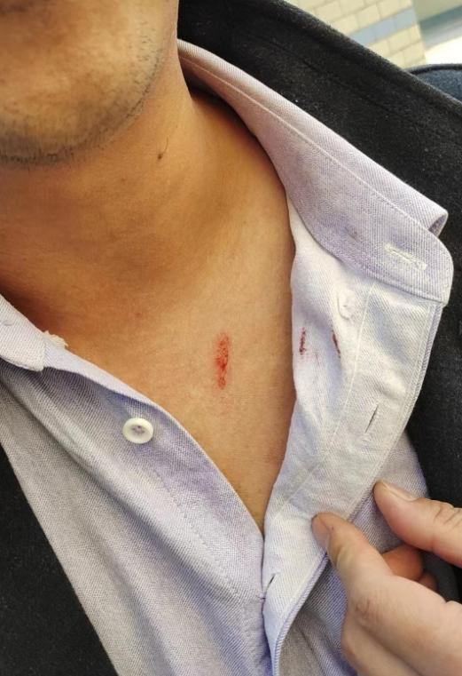 事情起因是因为第一名女生在教室辱骂老师引起公愤了,把老师脖子挖伤