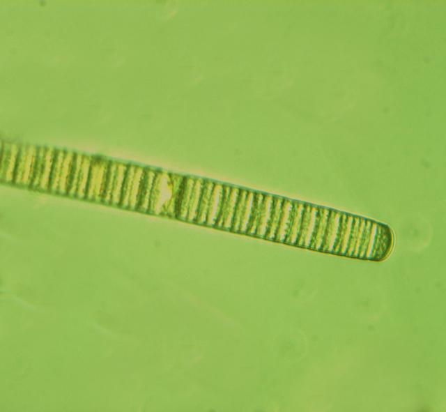 颤藻,易引起水华.受访者供图