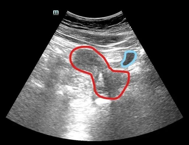 b超门前,这尿,憋还是不憋?