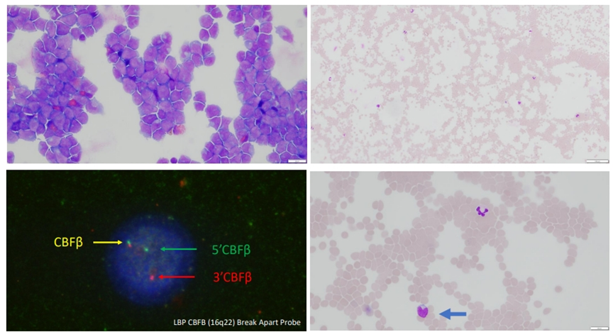 以下为使用安必平fish探针示意图