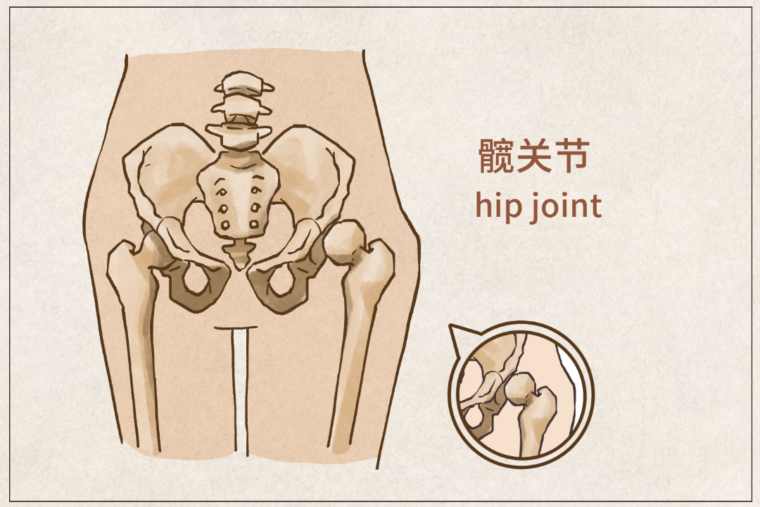 进而引起盂唇和髋臼边缘的软骨损伤,是年轻人髋关节疼的常见原