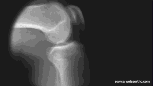 提高关节活动能力