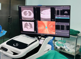NeuroLogica什么意思移动CT中国行 | 一站式超微创、高精准的肺结节治疗新方法-上海聚慕医疗器械有限公司