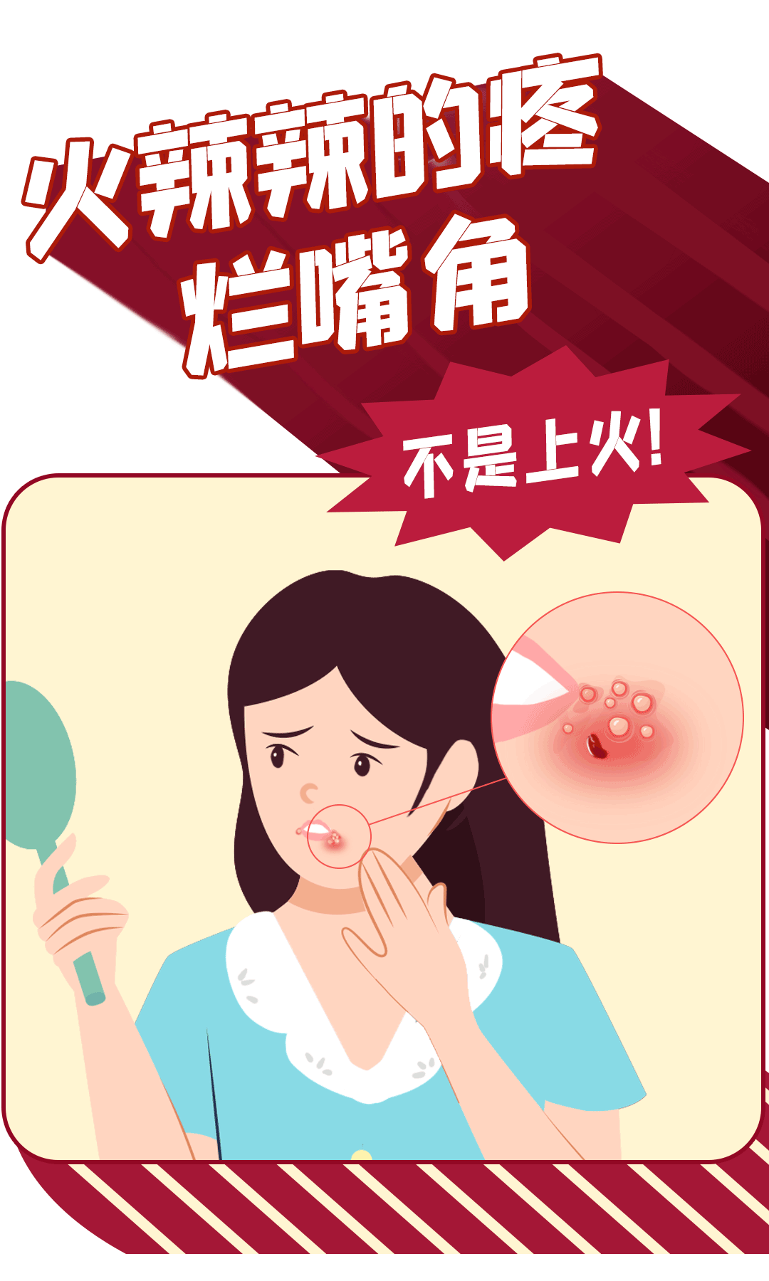 嘴上起泡不是上火!