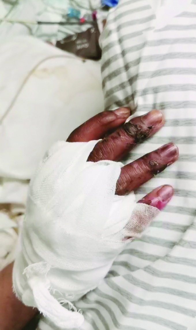 大学生夜游网红打卡地被电伤 野景点盲目跟风危险