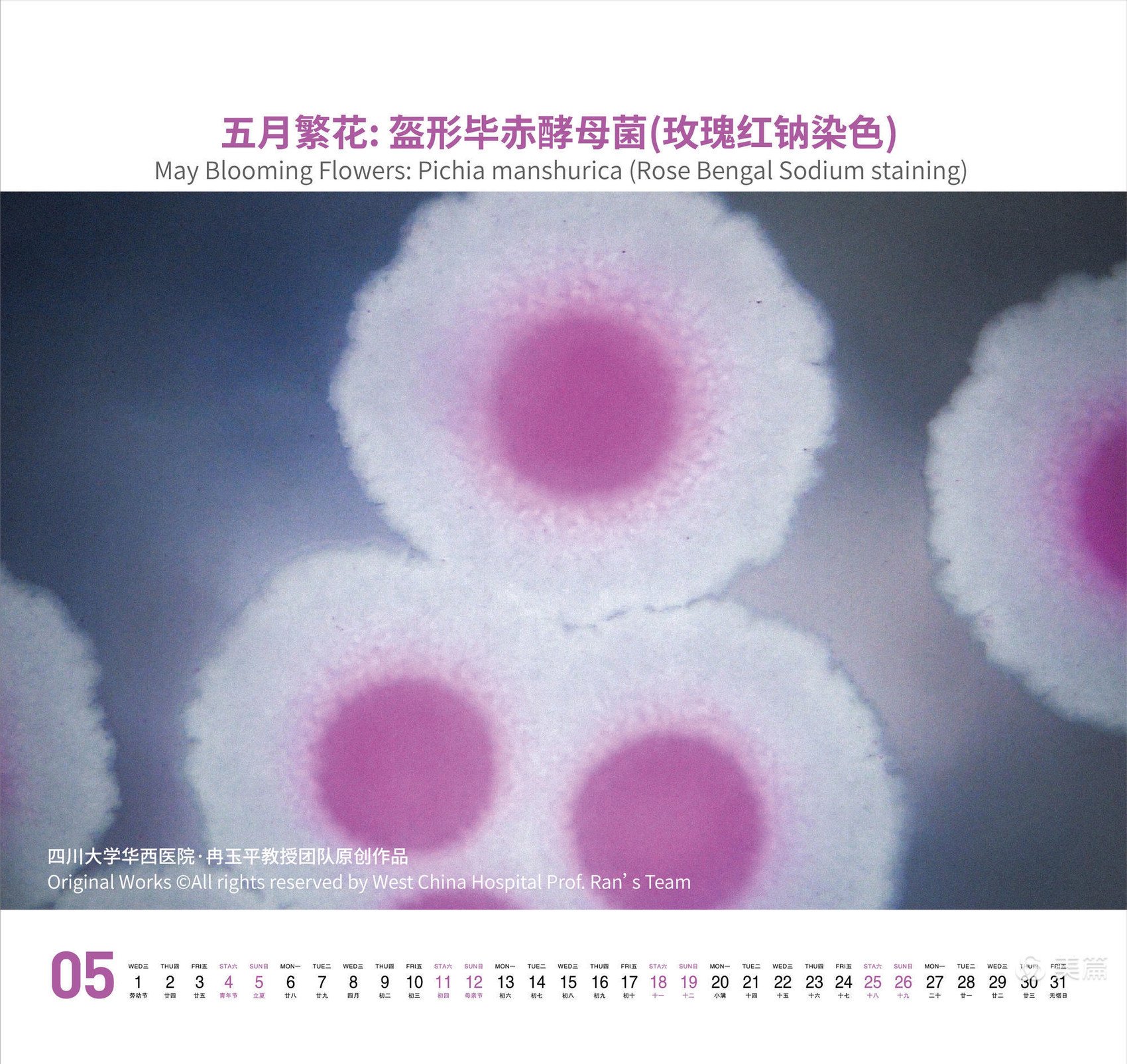 5月繁花盛开,此图是盔形毕赤酵母菌在玫瑰红钠培养基生长的菌落,在