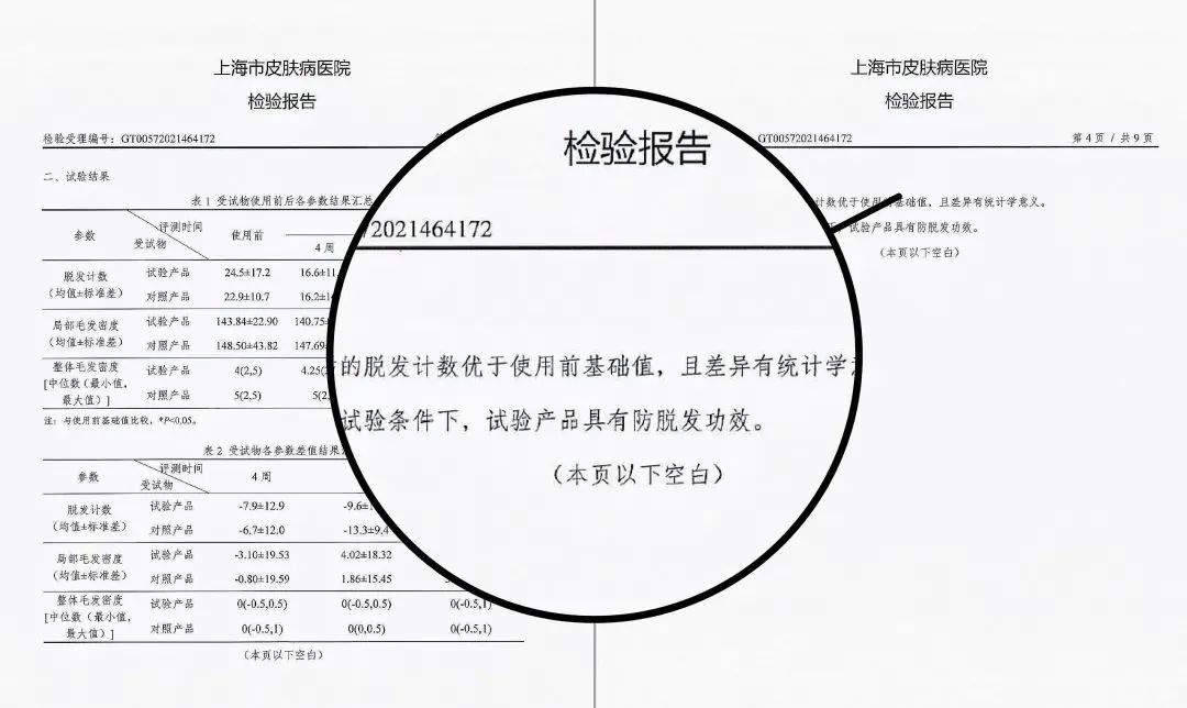 洗头狂掉发?一个新玩意儿,还真能挽回头发