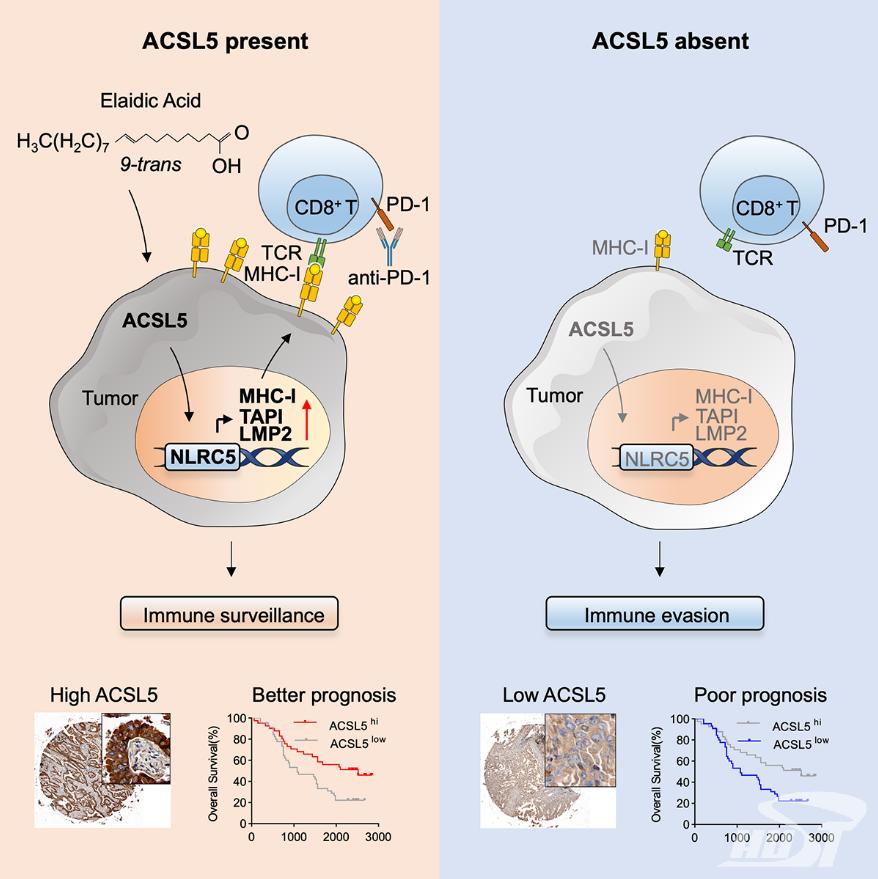 图1. ACSL5介导的EA代谢促进肿瘤抗原呈递并增敏免疫治疗