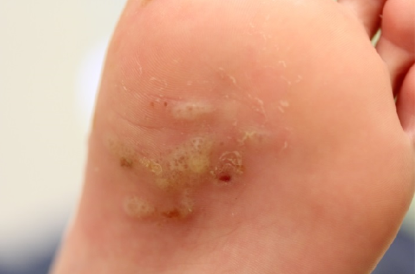 图片来源:https://www.semanticscholar.org