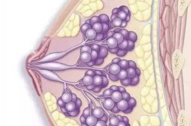 "乳腺导管扩张症"又称"浆细胞性乳腺炎","肉芽肿性小叶性乳腺炎"和"