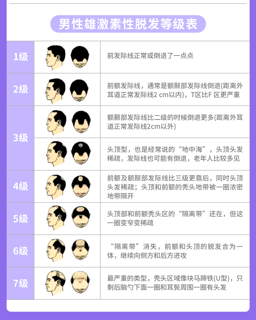 那就给大家用一张图来解答一下脱发等级.