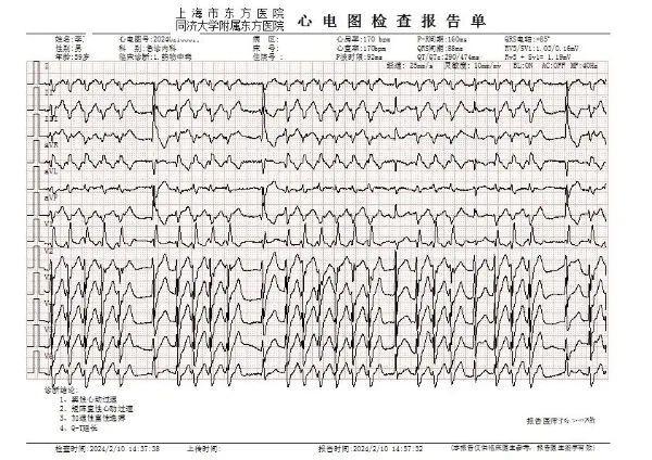 刚被送到东方医院急诊那会儿,李先生情况危急:心电监护显示心率快至