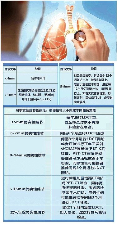 近年来,肺结节成为体检报告单上的常客,让不少人十分恐慌.