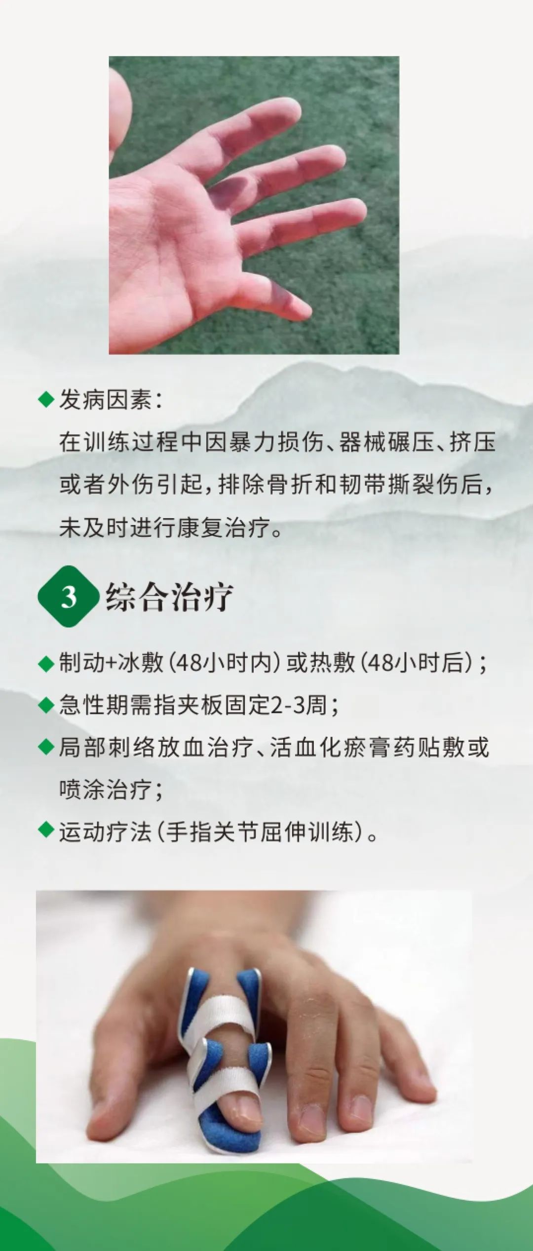解忧服务社之军事训练伤防治|手指关节损伤该怎么处理?_新浪财经_新浪网