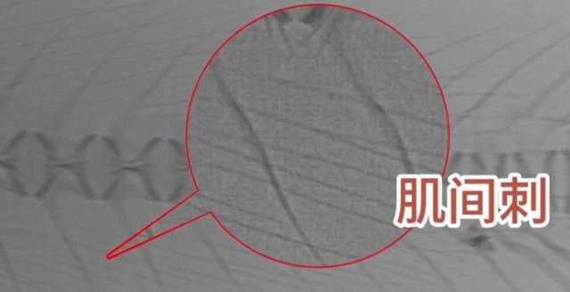 “无刺”草鱼来了:少了100多根刺,可放心大口“炫”丨科技观察|基因|鱼刺|教授|关键|养殖_手机新浪网