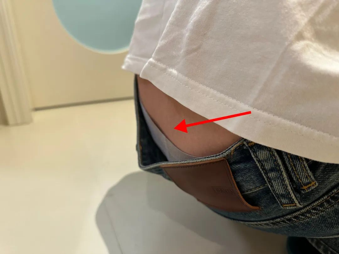 肛门一蹲下就出来一块东西