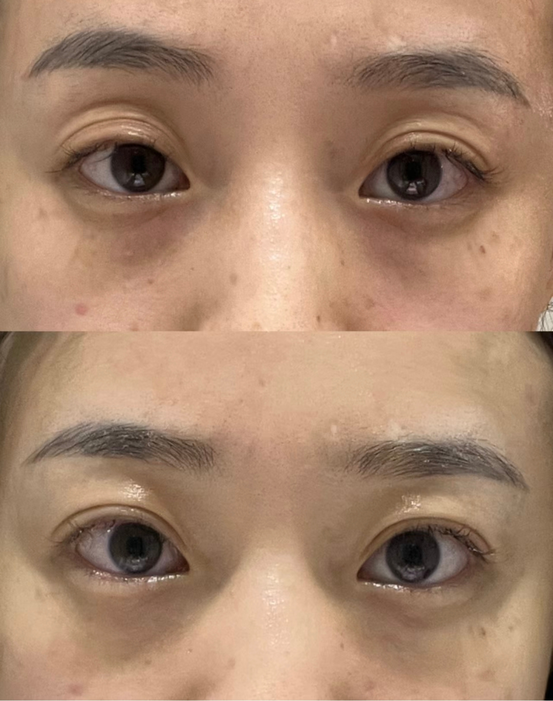 日本家用"眼部热玛吉",让我省下上万美容费!_新浪财经_新浪网