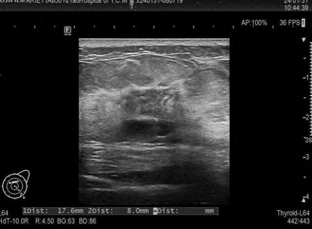 当场懊悔:只是皮肤有点痒,万万没想到…|乳腺癌_新浪财经_新浪网