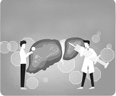 守护"小心肝" 远离肝硬化|肝脏_新浪财经_新浪网