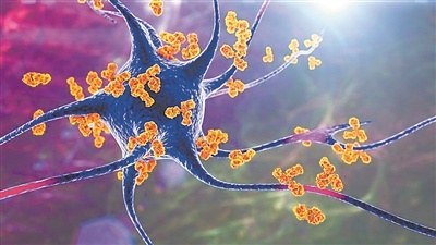 自身免疫性疾病治愈曙光初现|car-t_新浪财经_新浪网