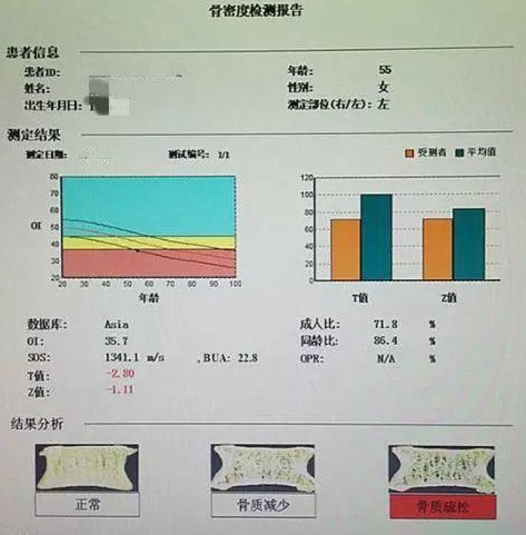 最近她去体检中心做了体检,体检报告的异常项提示"骨密度提示骨质疏松