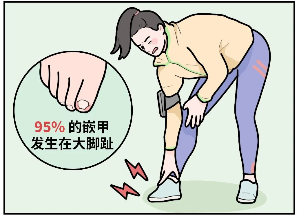 剪指甲的一个错误习惯让很多人痛苦不堪