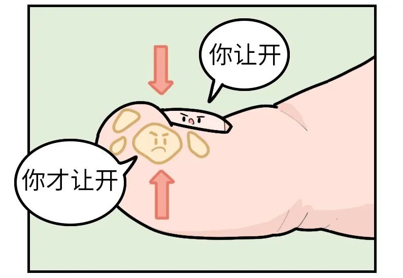 剪指甲的一个错误习惯让很多人痛苦不堪