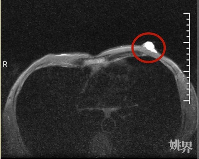 随后为陈先生安排了乳腺,淋巴结b超检查