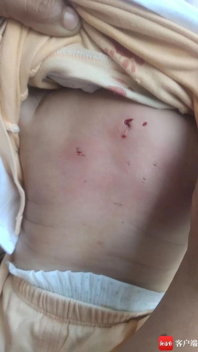 海南野猴进村伤人 还试图抓走婴儿(图4) 海南野猴进村伤人 还试图抓走婴儿(图4)