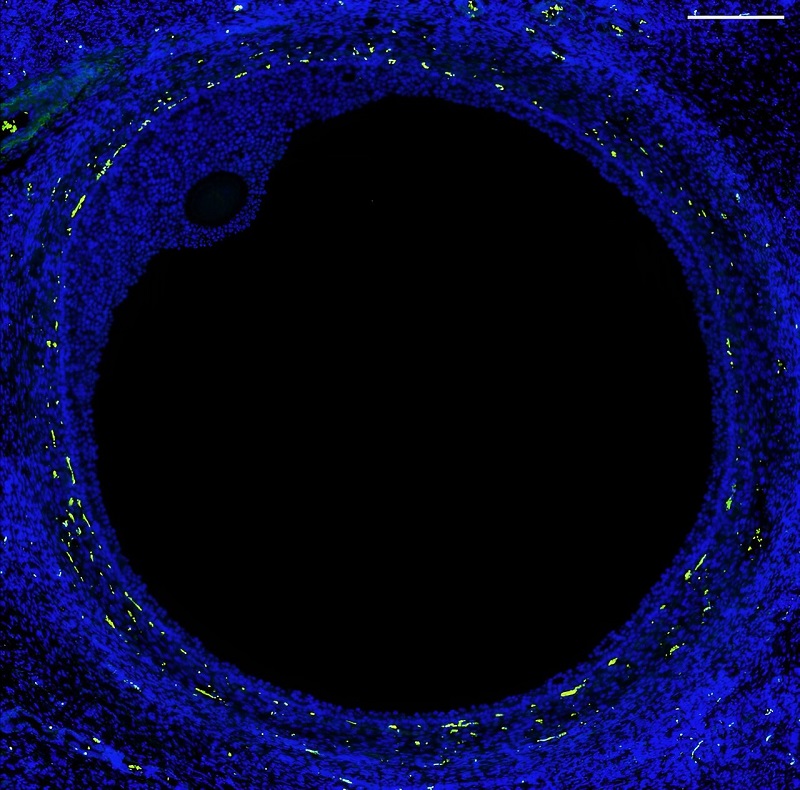 人类卵泡荧光图像清晰显示了各个不同部分,包括卵母细胞(小椭圆形)