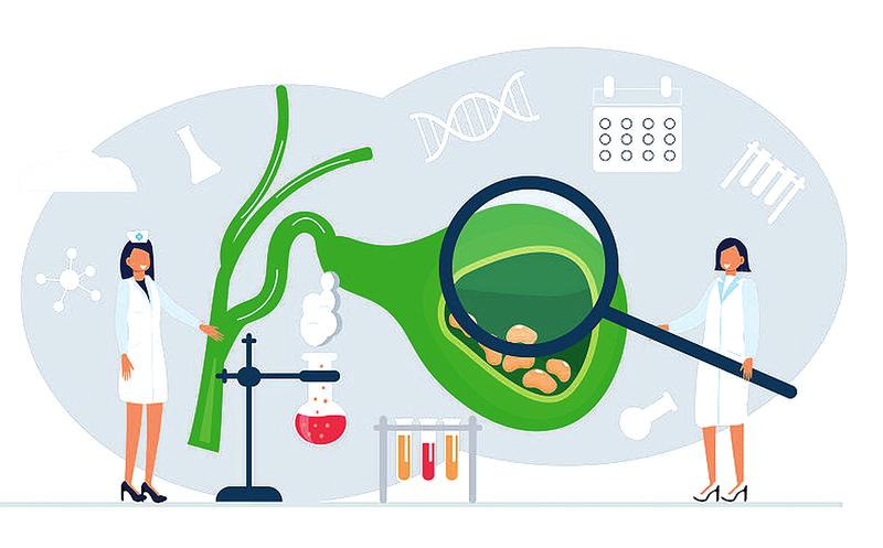 胆总管结石的复发因素及科学预防措施|结石_新浪财经_新浪网