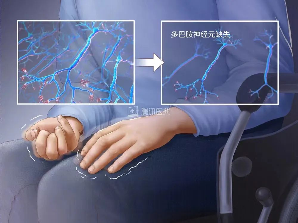 喝了广东老妈的符水后懒鬼上身的我靠摆烂火到国外