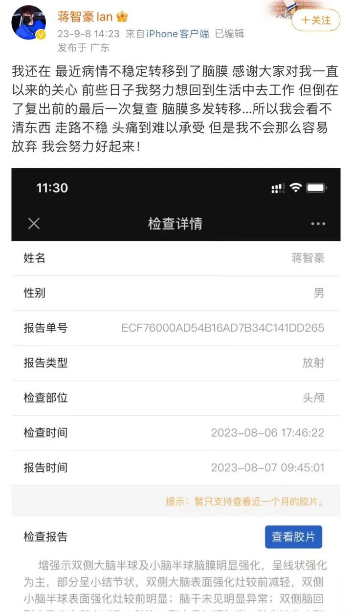 90后艺人确诊癌症晚期,已大面积转移!妈妈也因癌症离世……本人发声↗