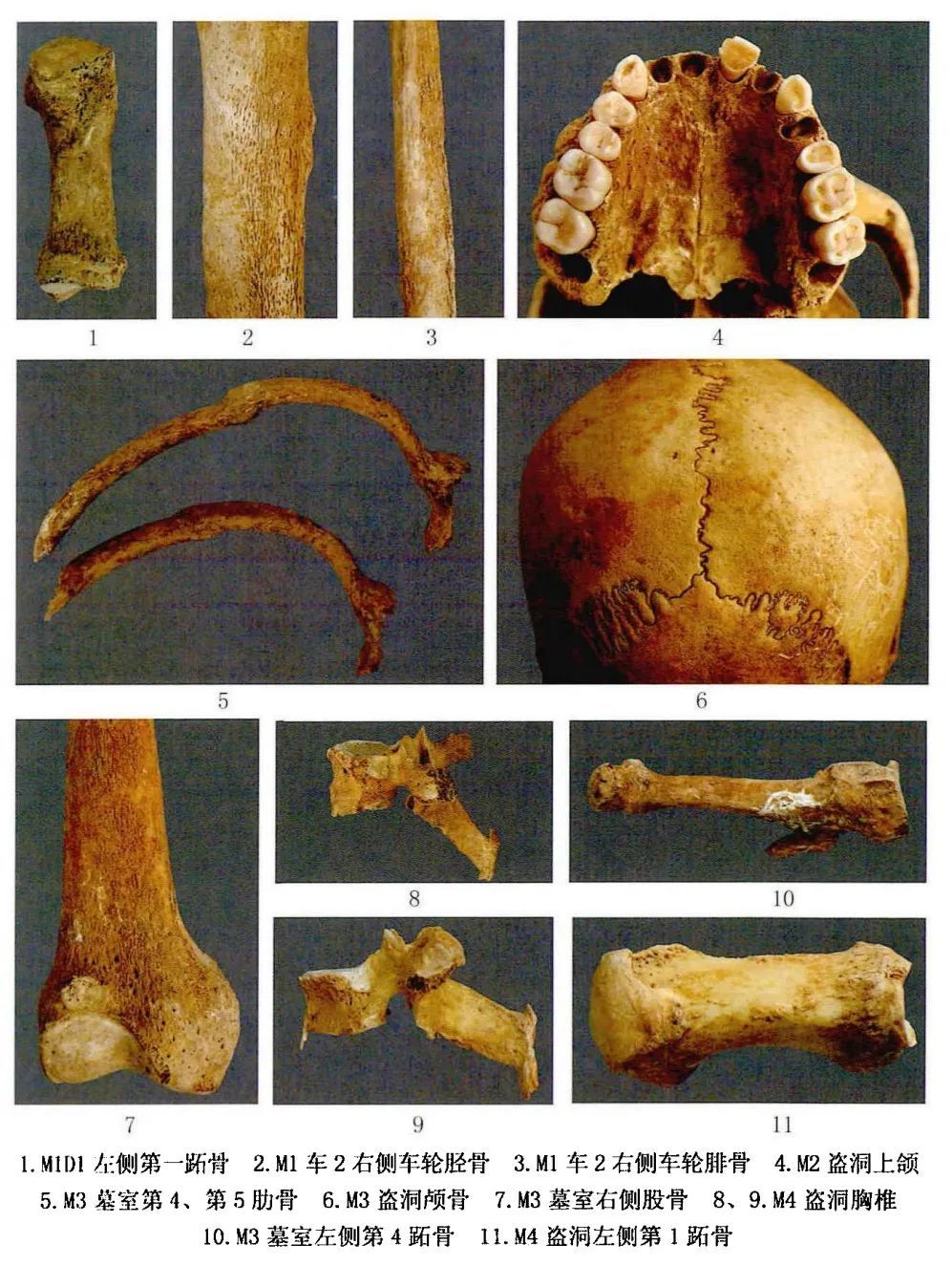 清涧后刘家塔商代贵族"骨膜炎""跪距面"现象高发_新浪财经_新浪网