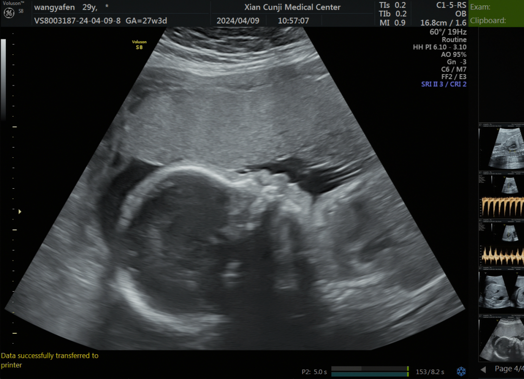 准爸爸准妈妈到西安存济妇产医院给宝宝做四维彩超,胎儿心脏b超检查