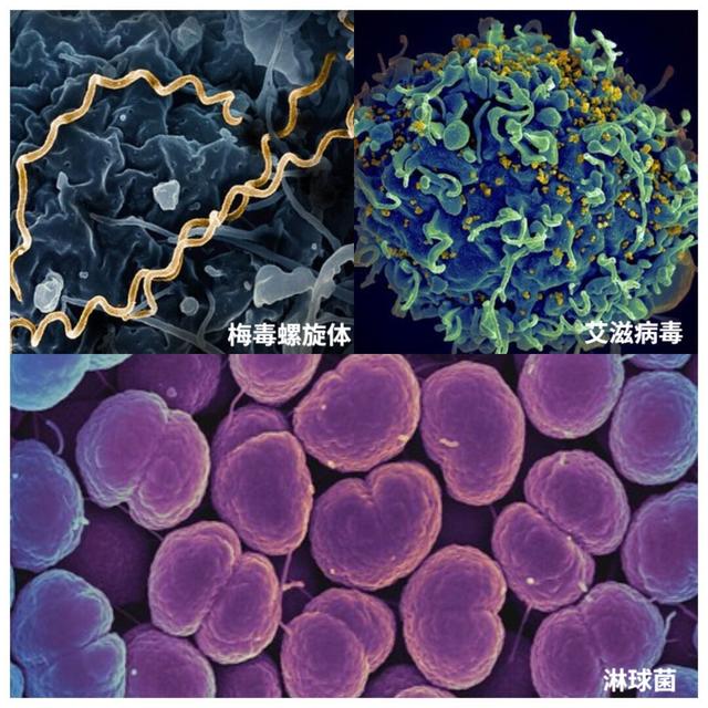 整个商场找不到一个蹲便器,蹲厕真的比坐厕更卫生吗?