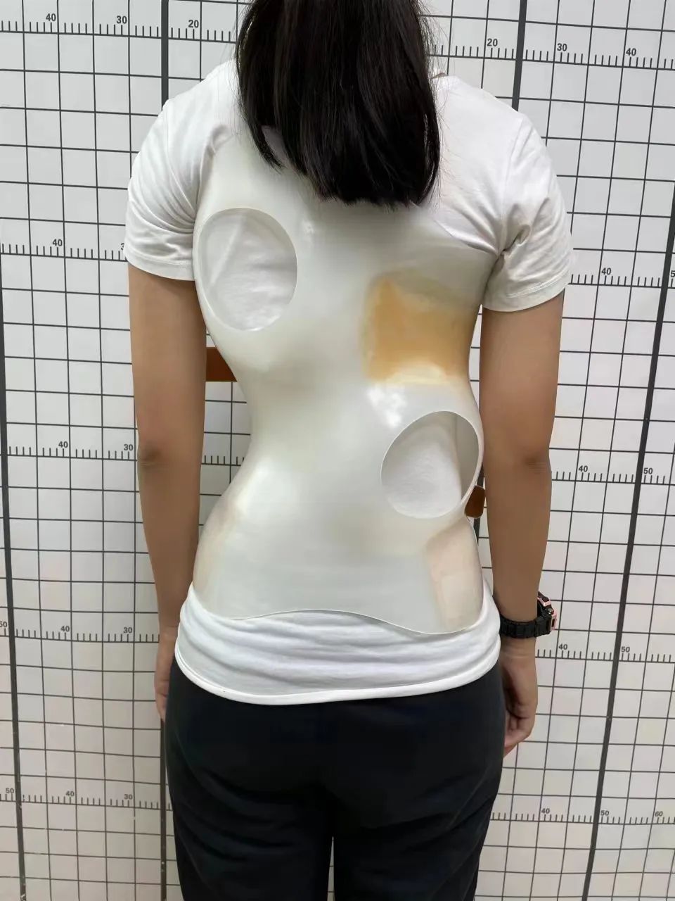 青少年出现驼背,高低肩?5步自查脊柱侧弯→ | 医生说