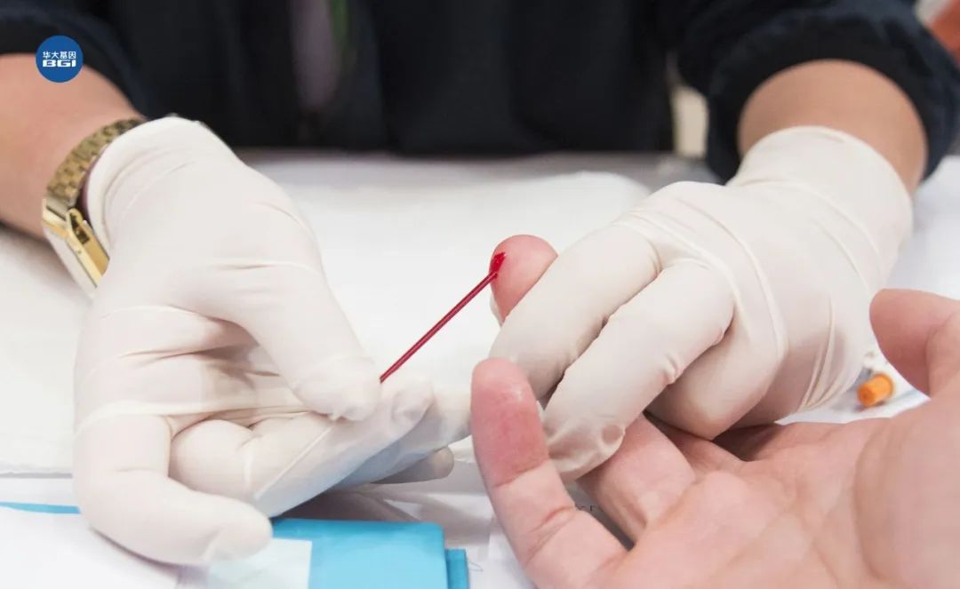 血型决定寿命长短?美国60万人研究发现:a型血60岁前或更易中风