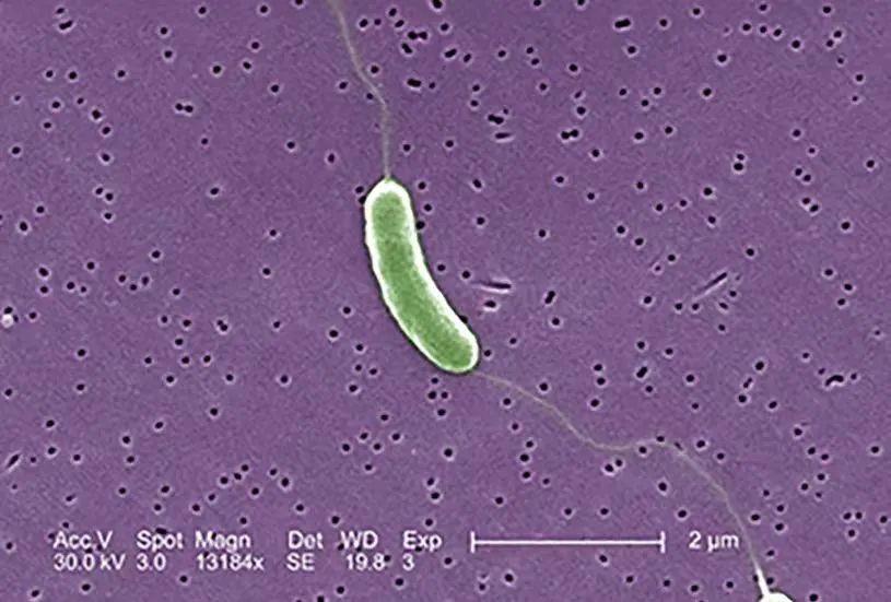 创伤弧菌属于弧菌科,是一种革兰氏阴性菌,是致死率最高的致病弧菌.