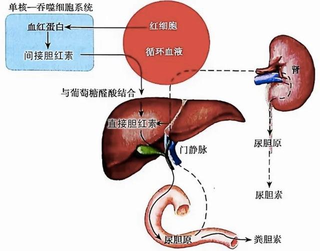 引起胆汁淤积,直接胆红素"产品滞销",无法及时排入肠道,返流回血液中