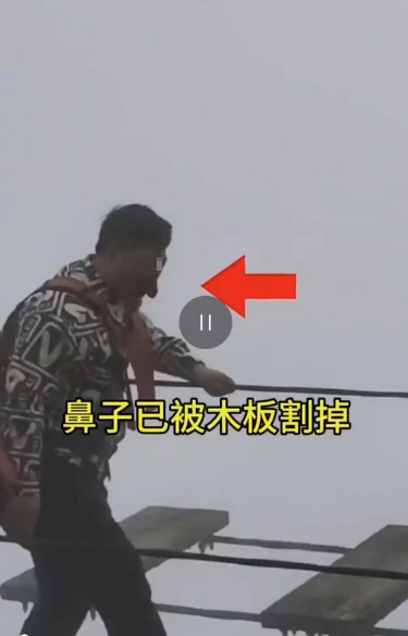 游客贵州铜仁玩“步步惊心”桥鼻子被割？当地文旅局：未割掉是磕破了，已送医