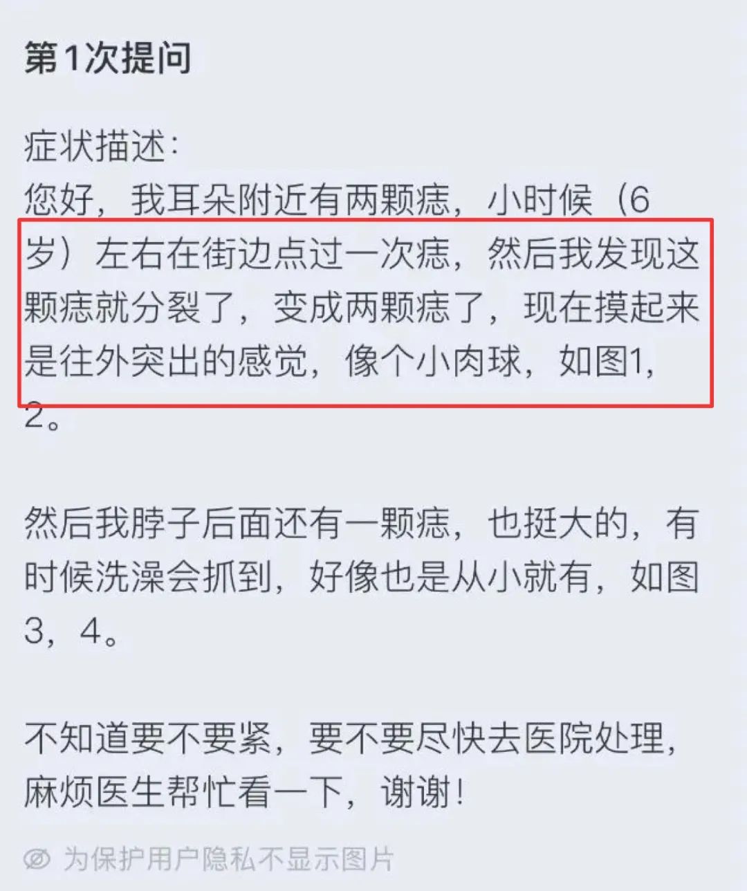 有 5 种痣要注意
