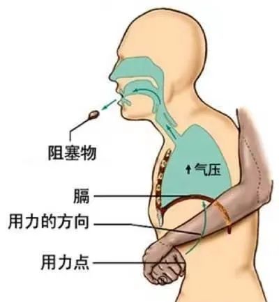 紧急提醒!正大量上市!丽水已有人因它中招.
