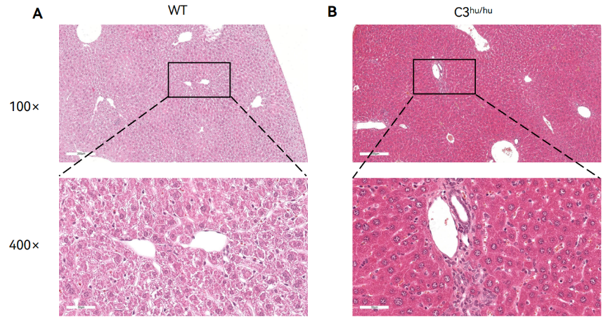 图13.C3人源化纯合子小鼠门静脉区出现炎症和胆管增生等症状