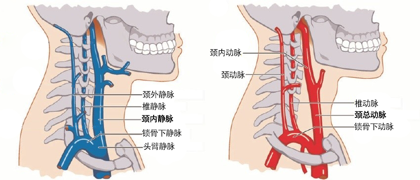 外力导致的血管内膜损伤是颈部静脉损伤最