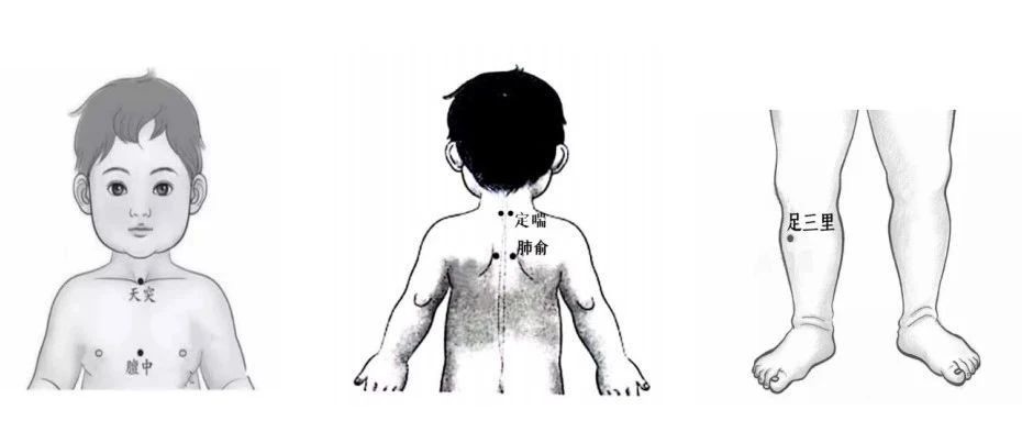 通过敷贴天突,膻中,定喘,肺俞,足三里穴位温阳散寒,调理脾胃,恢复元气