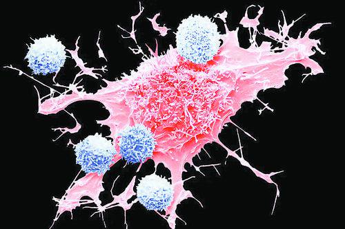 t细胞(蓝色)和淋巴瘤癌细胞(红色)的合成彩色扫描电子显微照片.