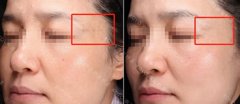 扒一扒!很多人不知道的抗衰新方法,能帮你少花冤枉钱